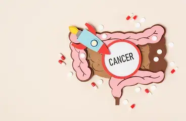 ../cancer-de-colon-cuando-se-deben-realizar-las-pruebas-de-deteccion