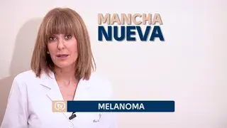 El melanoma