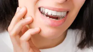 Invisalign: La ortodoncia perfecta