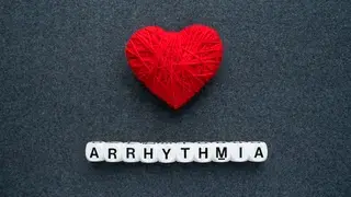 Fibrilación auricular: arritmia cardiaca