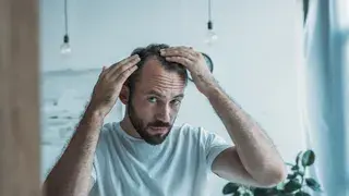 Alopecia frontal fibrosante: ¿se puede tratar?
