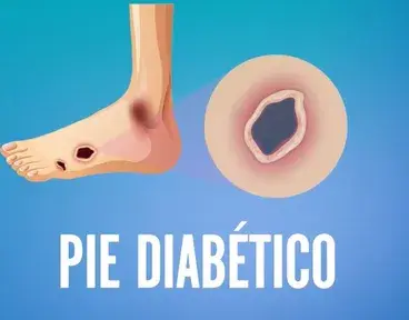 welcome-pack-diabetes-autocuidado-pies