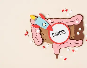 cancer-de-colon-cuando-se-deben-realizar-las-pruebas-de-deteccion